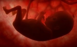 Abortion Rates Increase By 12% In Countries With Legal Restrictions – Report