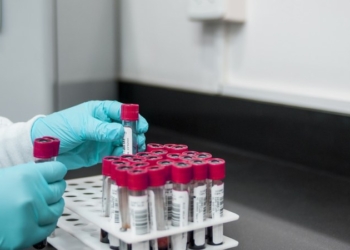 Improved Access to HIV Self-Testing Will Reduce Stigmatization – Prof Ezechi