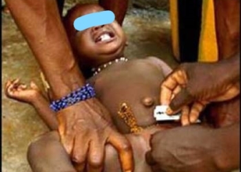 Fight Against Female Genital Mutilation Waning As Governments Ignore Women, Girls’ Rights