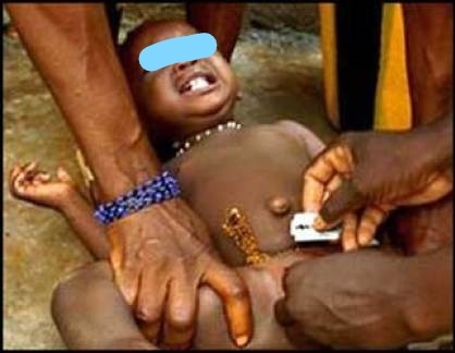 Fight Against Female Genital Mutilation Waning As Governments Ignore Women, Girls’ Rights