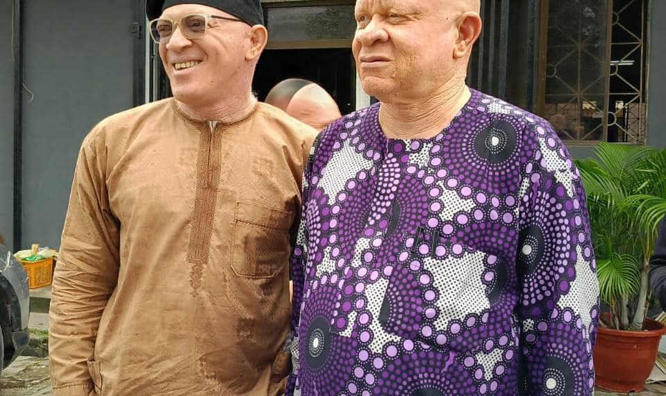 TANA Commemorates Albinism Awareness Day, Demands Inclusion in Key Sectors