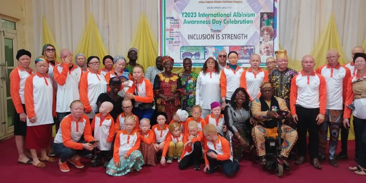 LAAF Commemorate Albinism Awareness Day 2023, Distributes Skin Protection Items to PWAs