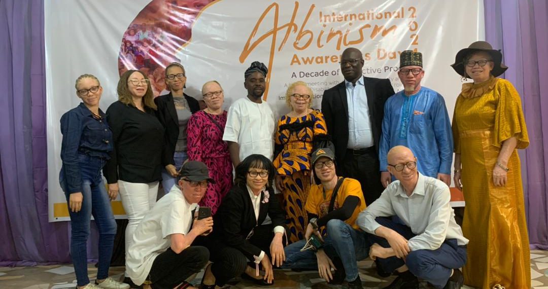 At Least Two People with Albinism Die Monthly Due to Skin Cancer in Nigeria – Bamishe