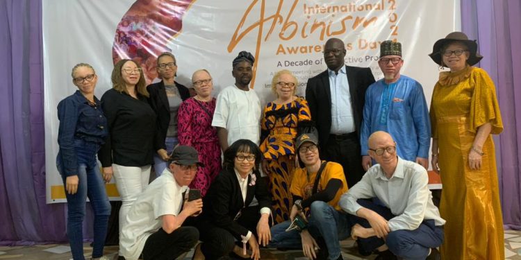 At Least Two People with Albinism Die Monthly Due to Skin Cancer in Nigeria – Bamishe