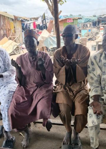 Image of Leprosy survivors at the Alabarago Lepers Community in Ojo LGA, Lagos.