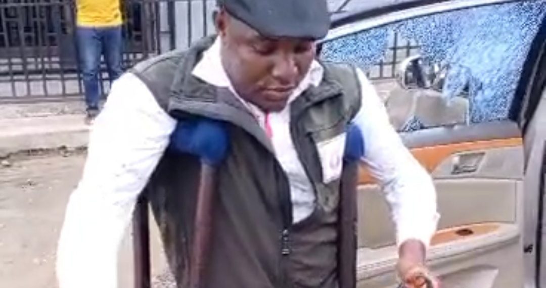 Political Thugs Attacked PWD Reporter During Rivers LG Election