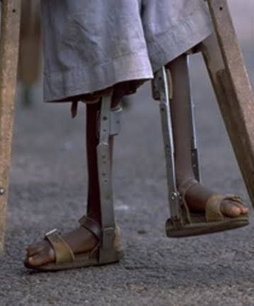 An image of a child with crutches without revealing the face