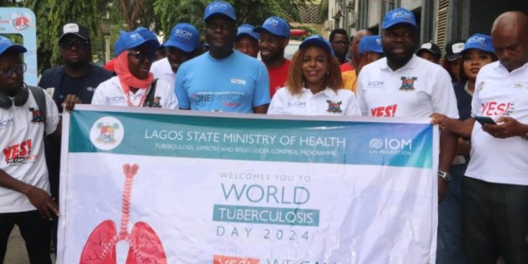 How Increase Uptake of TB Preventive Treatment Can Reduce TB Burden in Nigeria