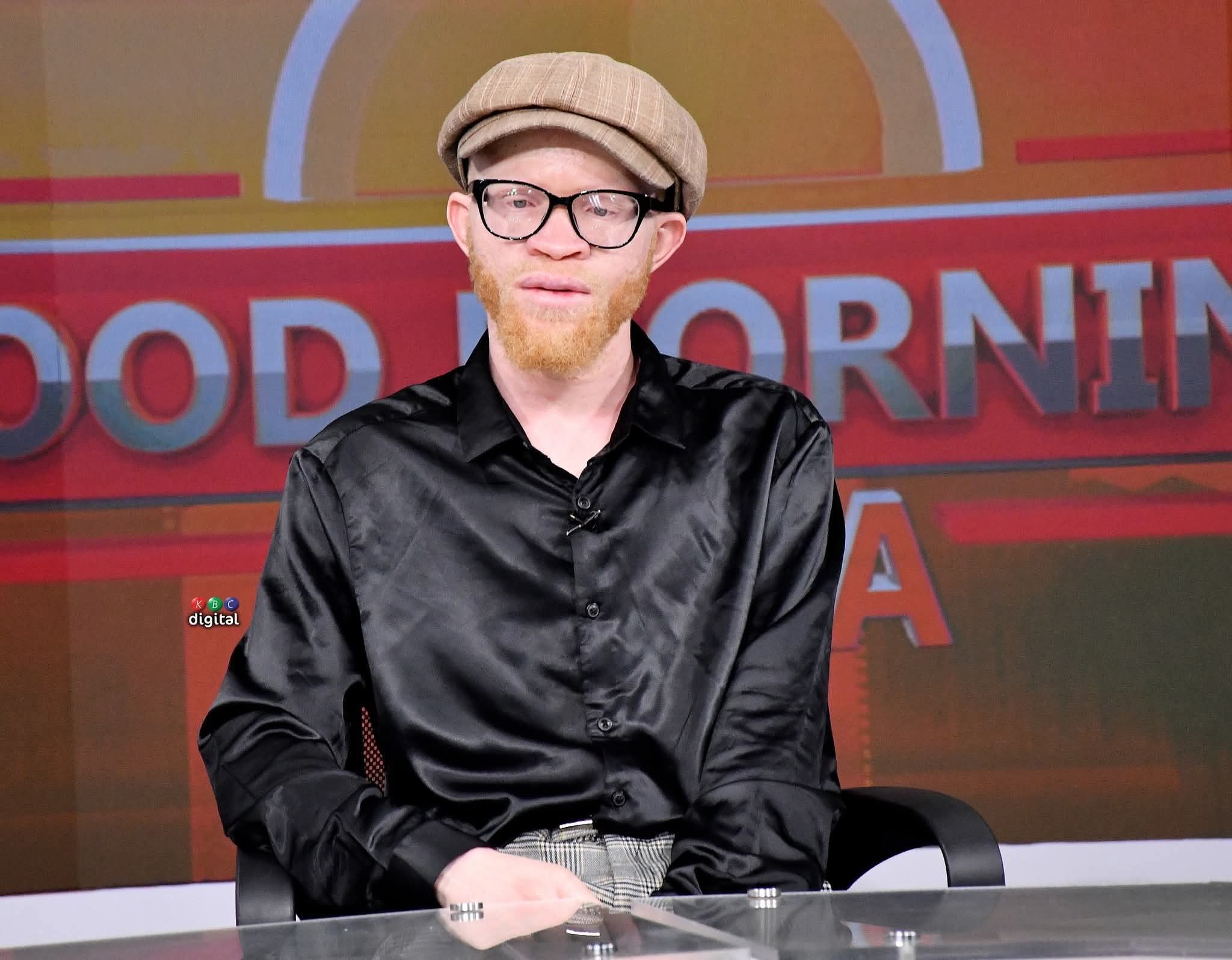 Meshack Sisenda, a man with albinism, sitting down with 'Good morning' at the background.